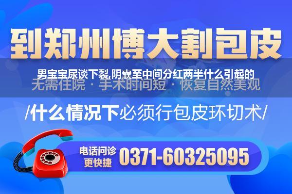 尿谈口下裂阴囊(尿谈下裂会伴发有其它疾病吗)